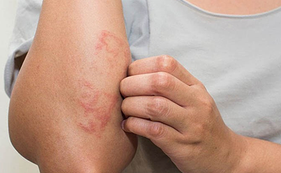 Skin Repair